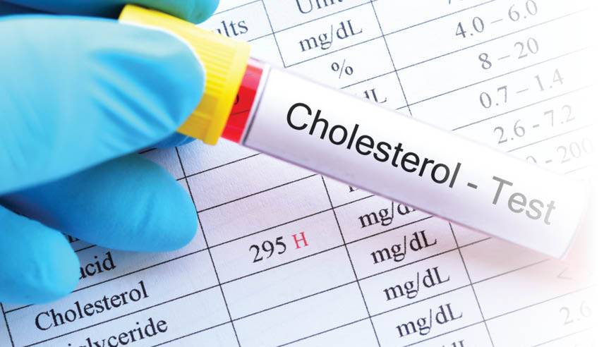 خطر کلسترول بالا با رفتارهای غلط
